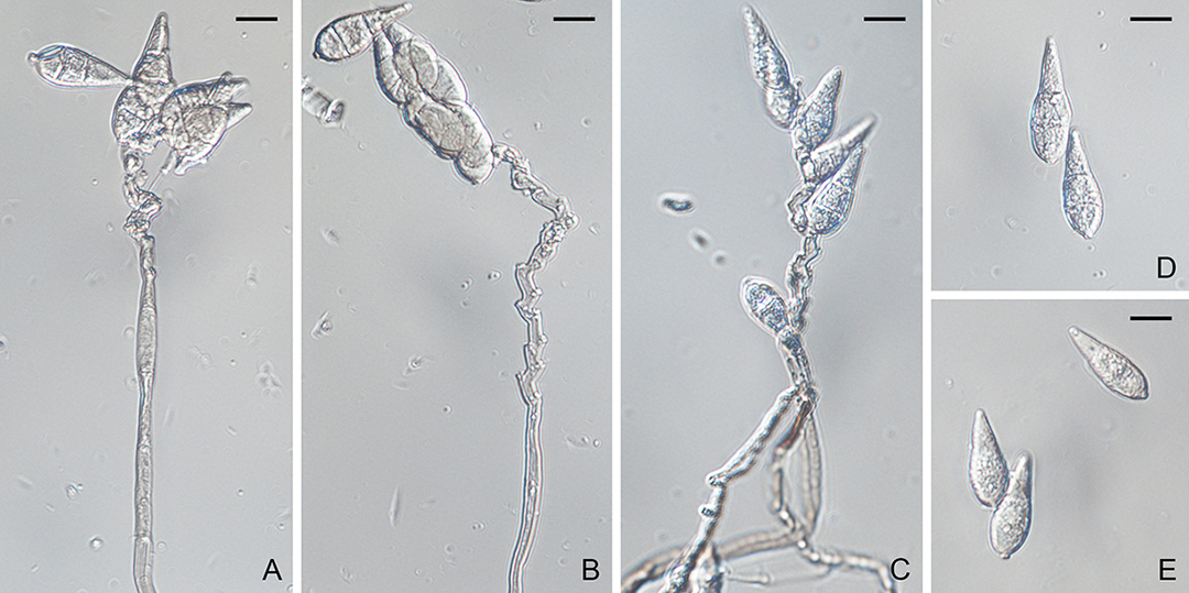 Pyricularia Grisea An E Monograph Of The Fungal Order Magnaporthales